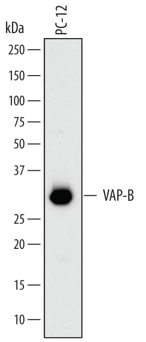 Detection of Rat VAP-B antibody by Western Blot.