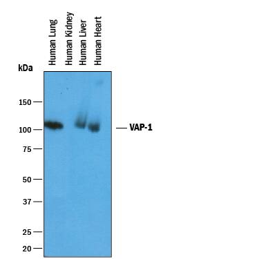 Detection of Human VAP-1/AOC3 antibody by Western Blot.