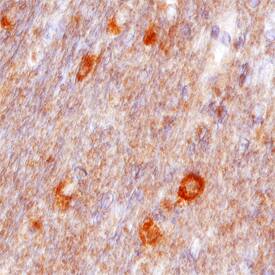 VAP-B antibody in Human Brain by Immunohistochemistry (IHC-P).