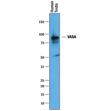 Detection of Human VASA antibody by Western Blot.