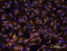 VCAM-1/CD106 antibody in HUVEC Cells by Immunocytochemistry (ICC).