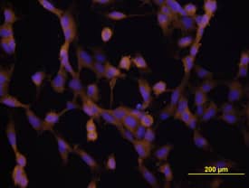 VEGF antibody in HUVEC Cells by Immunocytochemistry (ICC).
