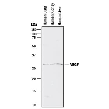 Detection of Human VEGF antibody by Western Blot.