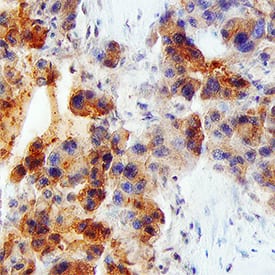 VEGF antibody in Human Liver by Immunohistochemistry (IHC-P).