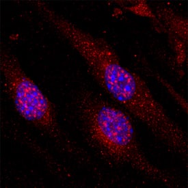 VG5Q antibody in bEnd by Immunocytochemistry (ICC).3 Mouse Cell Line by Immunocytochemistry (ICC).