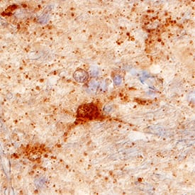 VGLUT1/SLC17A7 antibody in Human Brain by Immunohistochemistry (IHC-P).