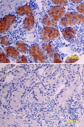 VIP antibody in Human Stomach by Immunohistochemistry (IHC-P).