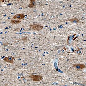 VMAT2 antibody in Human Brain by Immunohistochemistry (IHC-P).