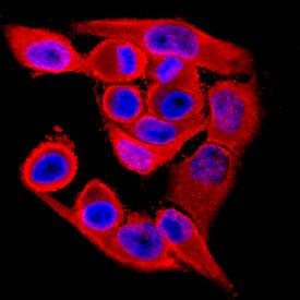 VRK1 antibody in HeLa Human Cell Line by Immunocytochemistry (ICC).