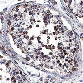 VRK1 antibody in Human Testis by Immunohistochemistry (IHC-P).