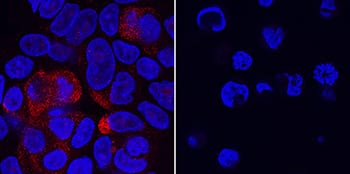 VSIG10 antibody in RT-4 and MOLT-4 Human Cell Lines by Immunocytochemistry (ICC).