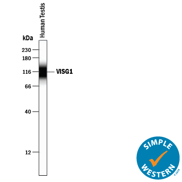 Detection of Human VSIG1 antibody by Simple WesternTM.