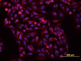 Vang-like Protein 1/VANGL1 antibody in HeLa Human Cell Line by Immunocytochemistry (ICC).