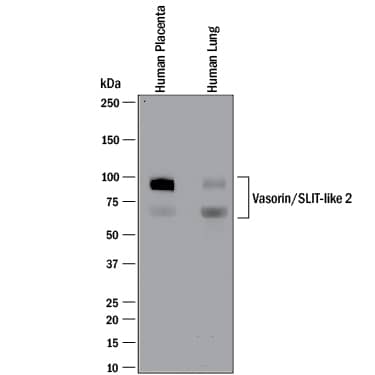 Detection of Human Vasorin/SLIT-like 2 antibody by Western Blot.