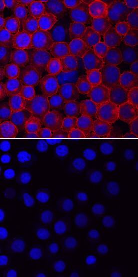 Phospho-Vav-1 (Y160) antibody in Jurkat Human Cell Line by Immunocytochemistry (ICC).
