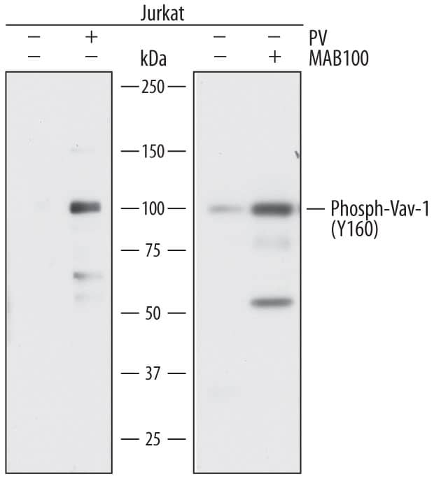 Detection of Human Phospho-Vav-1 (Y160) antibody by Western Blot.