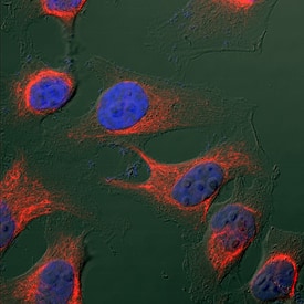 Vimentin antibody in HeLa Human Cell Line by Immunocytochemistry (ICC).