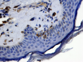 Vimentin antibody in Human Skin by Immunohistochemistry (IHC-P).