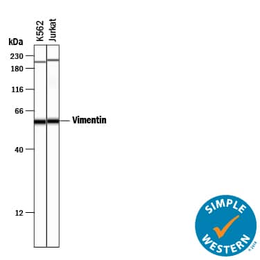 Detection of Human Vimentin antibody by Simple WesternTM.
