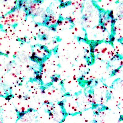 Vimentin antibody in Human Tonsil Using Dual RNAscope®ISH and IHC.