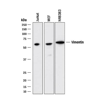 Detection of Human, Mouse, and Rat Vimentin antibody by Western Blot.