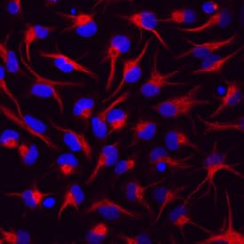 Vimentin antibody in Rat Cortical Stem Cells by Immunocytochemistry (ICC).