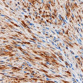 Vinculin antibody in Human Uterus by Immunohistochemistry (IHC-P).