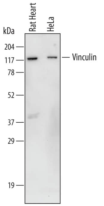 Detection of Human and Rat Vinculin antibody by Western Blot.