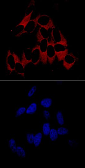 Vinculin antibody in HeLa Human Cell Line by Immunocytochemistry (ICC).