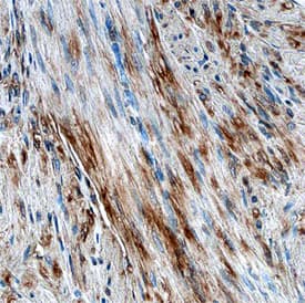 Vinculin antibody in Human Uterus by Immunohistochemistry (IHC-P).