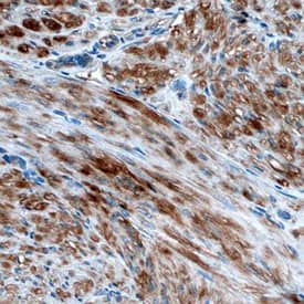 Vinculin antibody in Human Uterus by Immunohistochemistry (IHC-P).