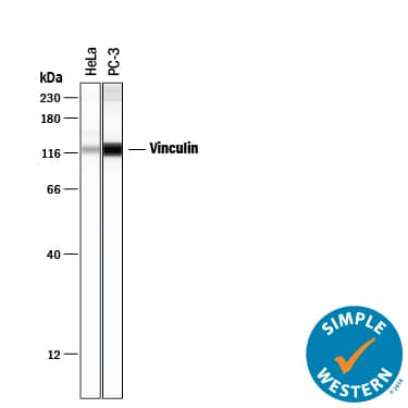Detection of Human Vinculin antibody by Simple WesternTM.