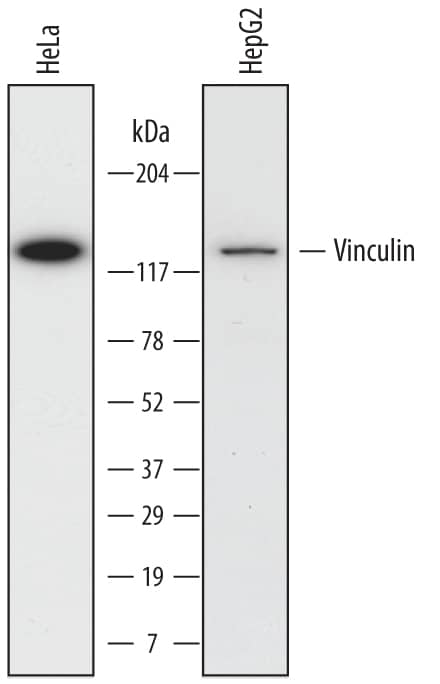 Detection of Human Vinculin antibody by Western Blot.