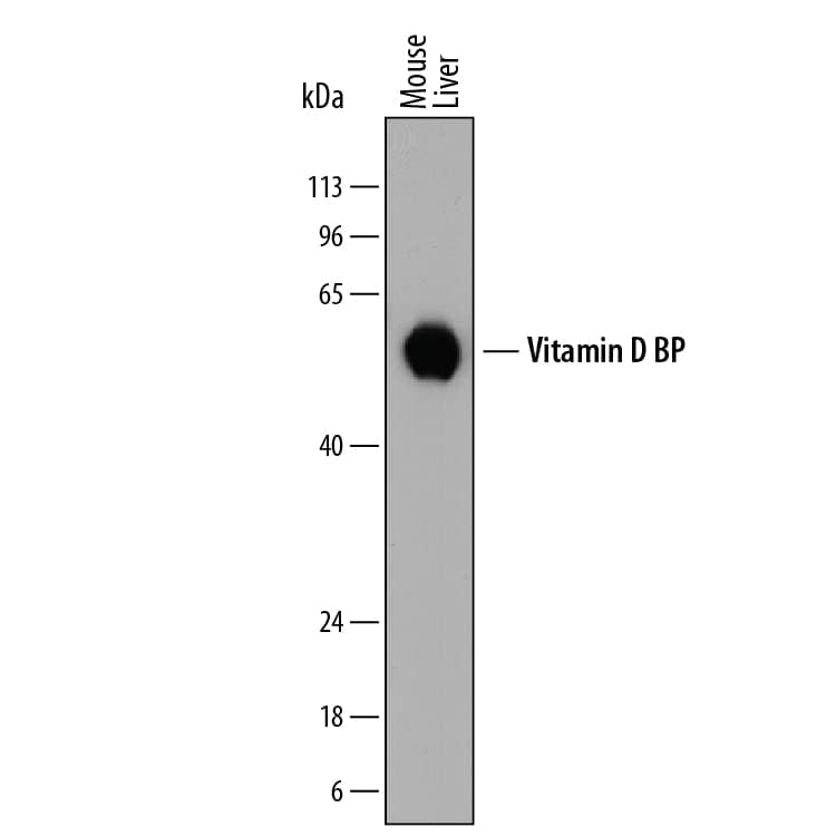 Detection of Mouse Vitamin D BP antibody by Western Blot.