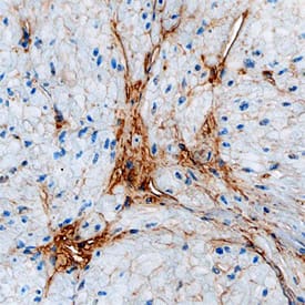 Vitronectin antibody in Human Bladder by Immunohistochemistry (IHC-P).