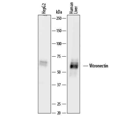 Detection of Human Vitronectin antibody by Western Blot.