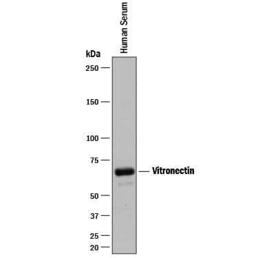 Detection of Human Vitronectin antibody by Western Blot.