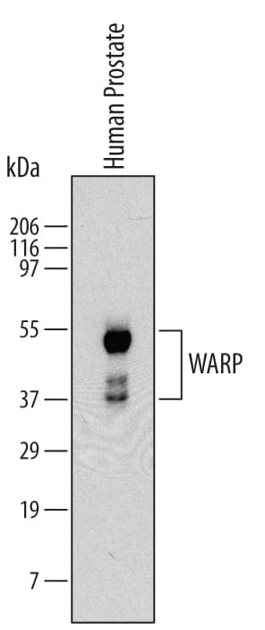 Detection of Human WARP antibody by Western Blot.