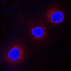 WASP antibody in Jurkat Human Cell Line by Immunocytochemistry (ICC).