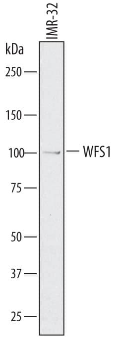 Detection of Human WFS1 antibody by Western Blot.