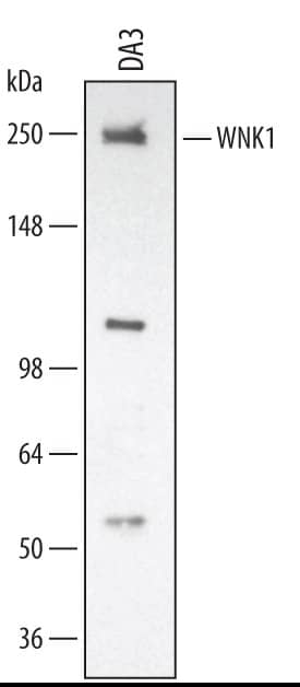 Detection of Mouse/Rat WNK1 antibody by Western Blot.