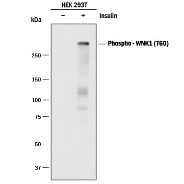 Detection of Human Phospho-WNK1 (T60) antibody by Western Blot.