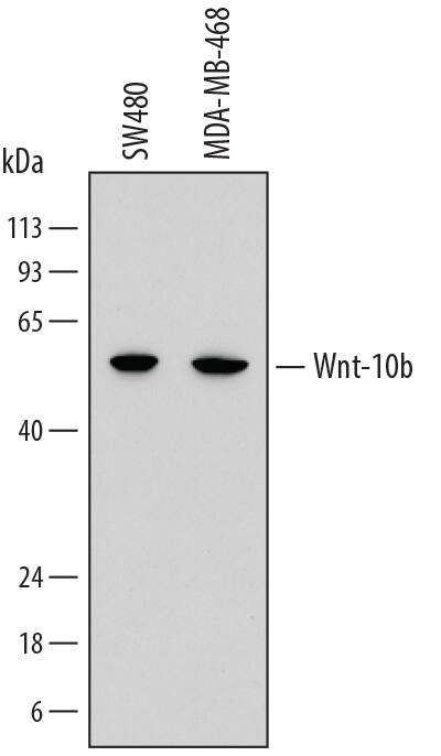 Detection of Human Wnt-10b antibody by Western Blot.