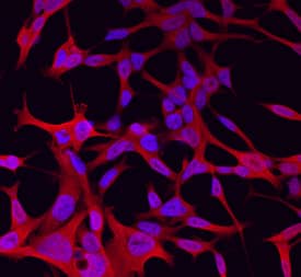 Wnt-11 antibody in LNCaP Human Cell Line by Immunocytochemistry (ICC).