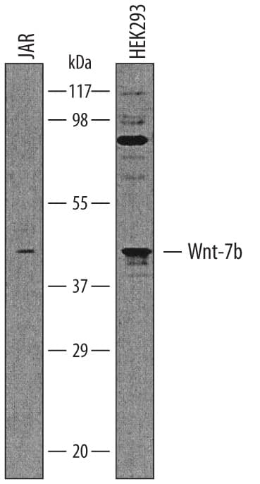 Detection of Human Wnt-7b antibody by Western Blot.