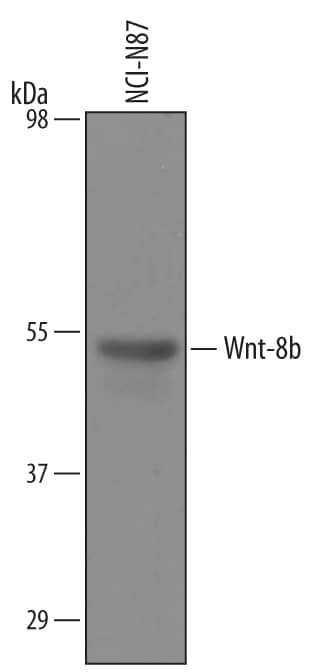 Detection of Human Wnt-8b antibody by Western Blot.