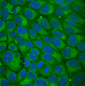 Wnt-5b antibody in NMuMG Mouse Cell Line by Immunocytochemistry (ICC).