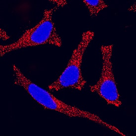 Wnt-7a antibody in HeLa Human Cell Line by Immunocytochemistry (ICC).