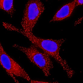 Wnt-7a antibody in HeLa Human Cell Line by Immunocytochemistry (ICC).