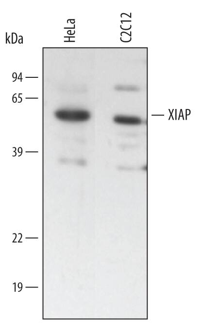 Detection of Human and Mouse XIAP antibody by Western Blot.